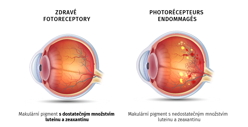 Eye PROtect